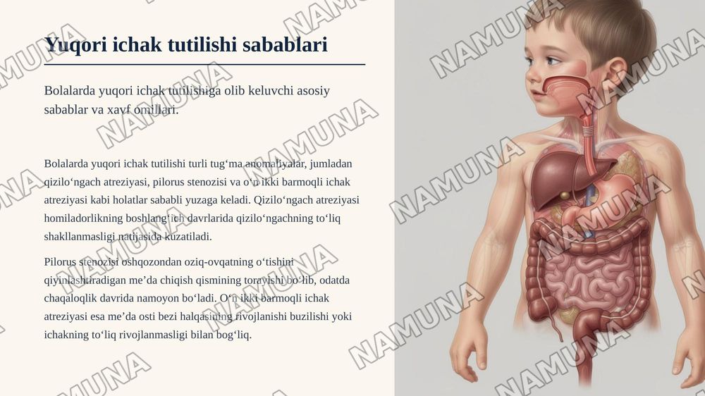 Diafragma tugʻma churralari.Bolalarda tugʻma yuqori va pastki ichak tutilishlari — zamonaviy taqdimot, 5-slayd