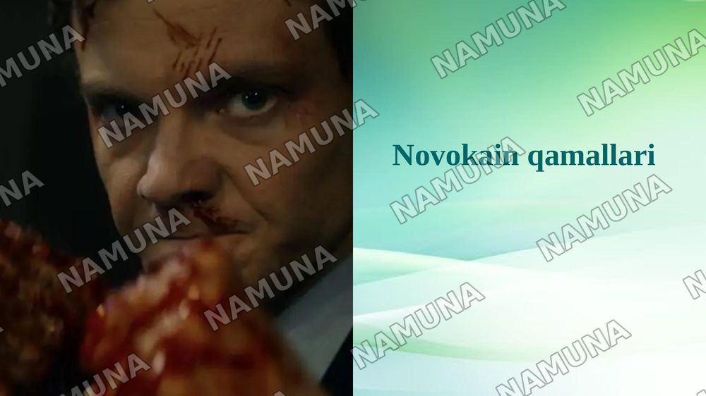 Novokain qamallari — taqdimot, 1-slayd