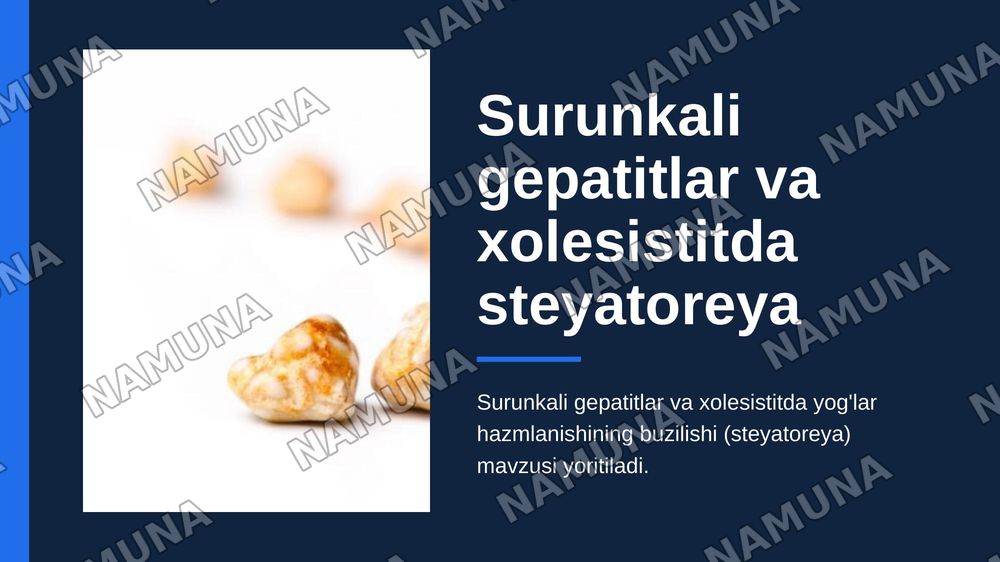 Surunkali gepatitlar.
Xolesistitda yoglar hazmlanishini buzulishi(steyatoreya) — zamonaviy taqdimot, 1-slayd