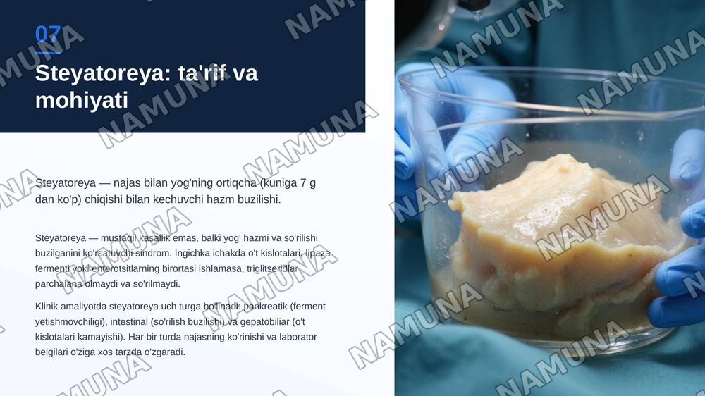 Surunkali gepatitlar.
Xolesistitda yoglar hazmlanishini buzulishi(steyatoreya) — zamonaviy taqdimot, 8-slayd