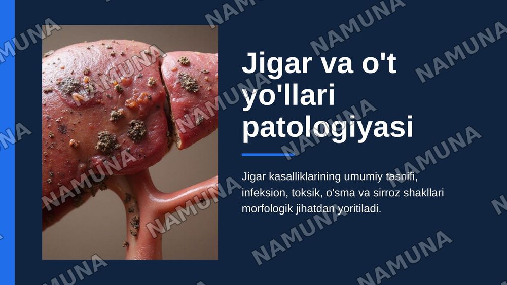 Jigar va o’t yo’llari patologiyasi. Jigar kasalliklari hagida umumiy ma’lumotiar.
Infeksion kasalliklar (virusli, bakterial, parazitar gepatitlar). Jigamni toksik va dori vositalari ta’sirida zararlanishi. Jigar o’smalari. Jigar sirrozlari, turlari morfologik xususiyatlari. — zamonaviy taqdimot, 1-slayd