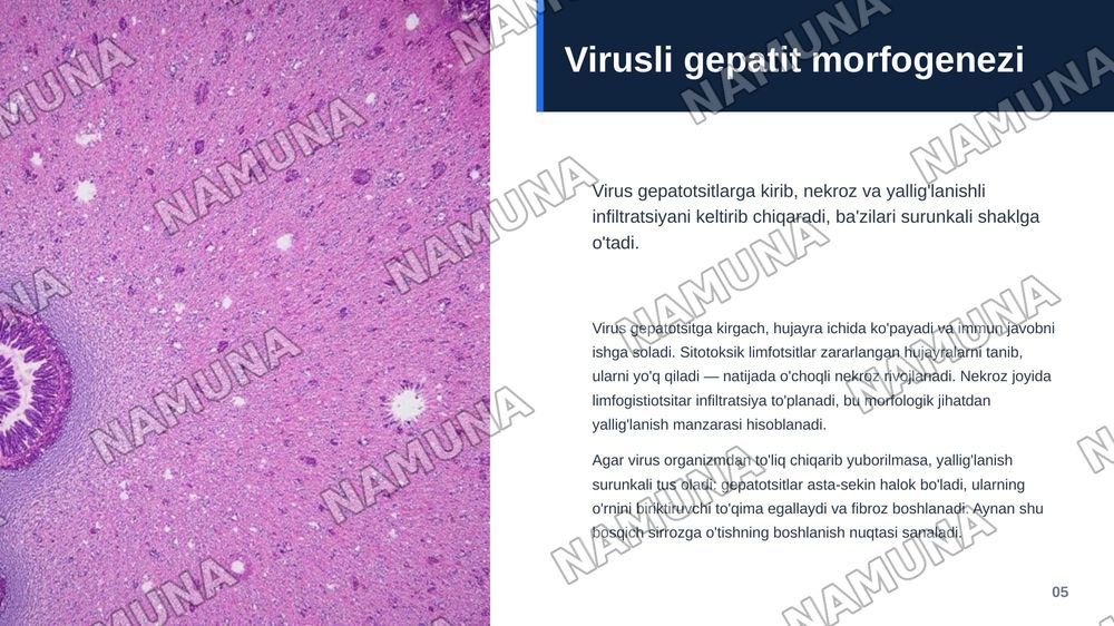 Jigar va o’t yo’llari patologiyasi. Jigar kasalliklari hagida umumiy ma’lumotiar.
Infeksion kasalliklar (virusli, bakterial, parazitar gepatitlar). Jigamni toksik va dori vositalari ta’sirida zararlanishi. Jigar o’smalari. Jigar sirrozlari, turlari morfologik xususiyatlari. — zamonaviy taqdimot, 6-slayd