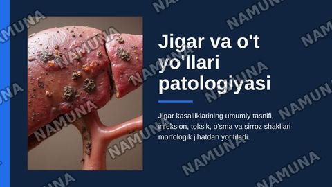 Jigar va o’t yo’llari patologiyasi. Jigar kasalliklari hagida umumiy ma’lumotiar.
Infeksion kasalliklar (virusli, bakterial, parazitar gepatitlar). Jigamni toksik va dori vositalari ta’sirida zararlanishi. Jigar o’smalari. Jigar sirrozlari, turlari morfologik xususiyatlari. — zamonaviy taqdimot