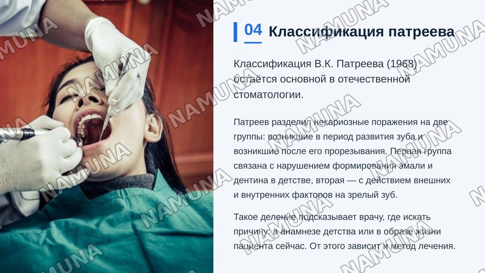 Классификации некариозных заболеваний твердых тканей зуба (классификация Патреева и другие классификации). — zamonaviy taqdimot, 5-slayd