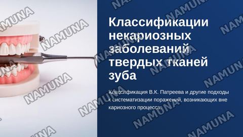 Классификации некариозных заболеваний твердых тканей зуба (классификация Патреева и другие классификации). — zamonaviy taqdimot