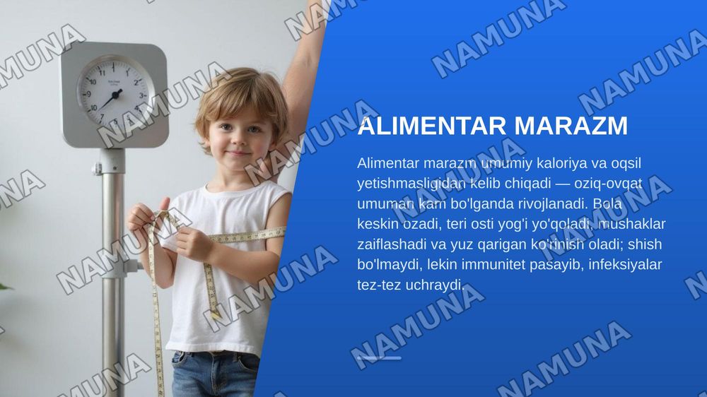 Oqsil almashinuvi patologiyasining umumiy jihatlari.
1.Kvashiorkor, alimentar marazm 2.Podagra. Kelib chiqish sabablari, alomatlari, profilaktikasi. Bu kasalliklarning olgini olishda to’g’ri ovqatlanishning ahamiyati. — zamonaviy taqdimot, 6-slayd