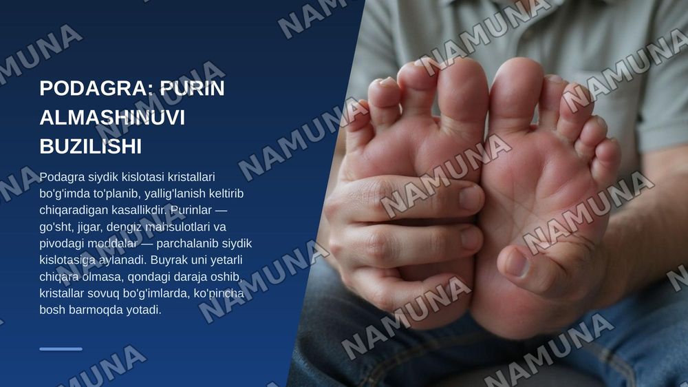 Oqsil almashinuvi patologiyasining umumiy jihatlari.
1.Kvashiorkor, alimentar marazm 2.Podagra. Kelib chiqish sabablari, alomatlari, profilaktikasi. Bu kasalliklarning olgini olishda to’g’ri ovqatlanishning ahamiyati. — zamonaviy taqdimot, 8-slayd