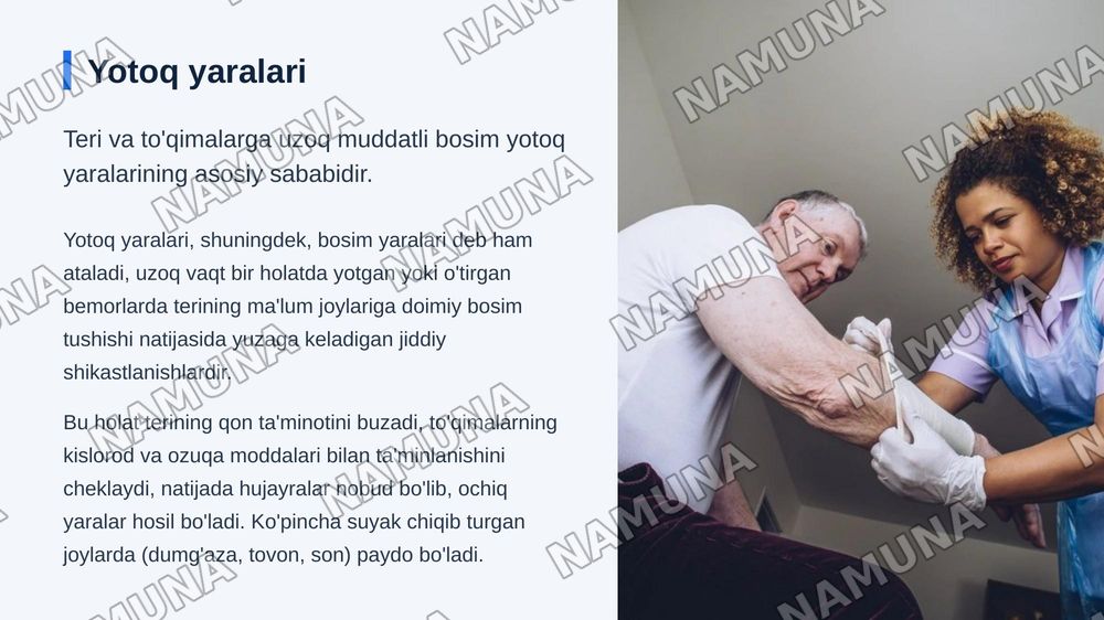 Bemorning tanasini parvarishlash  yotoq yaralar bemorlarni kiyintirish orin joyida almashtirish qoidalari.teri toshmalarida birinchi yordam Yotoq yarani rivojlanish sabablarini rivojlanishini davolash va oldini omish — zamonaviy taqdimot, 5-slayd