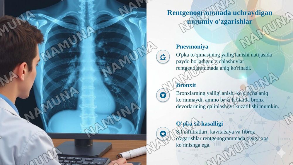 Nafas a'zolari kasalliklaridagi funksional-instrumental tekshiruvlar:rentgenogrammalar interpretatsiyasi. Chekishning nafas a'zolariga salbiy ta'siri. — taqdimot, 6-slayd