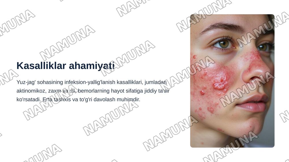 Yuz-jag‘ sohasining infeksion-yallig‘lanish kasalliklari: aktinomikoz, zaxm va sil. Klinikasi, diagnostikasi va differensial diagnostikasi. — zamonaviy taqdimot, 3-slayd