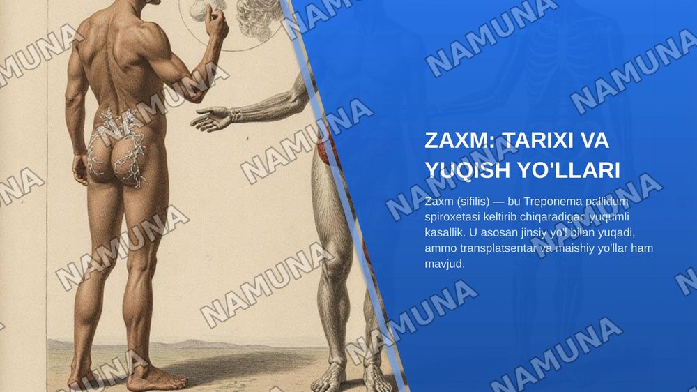 Yuz-jag‘ sohasining infeksion-yallig‘lanish kasalliklari: aktinomikoz, zaxm va sil. Klinikasi, diagnostikasi va differensial diagnostikasi. — zamonaviy taqdimot, 8-slayd