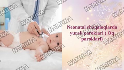 Neonatal chaqaloqlarda yurak paroklari ( Oq paroklari) — taqdimot