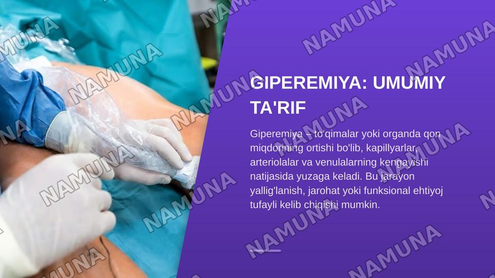 Arterial va venoz giperemiya — zamonaviy taqdimot, 4-slayd