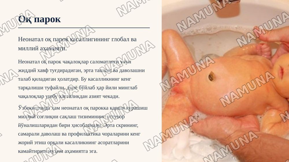 Неонатал чакалокларда ок парок касаллиги — zamonaviy taqdimot, 3-slayd