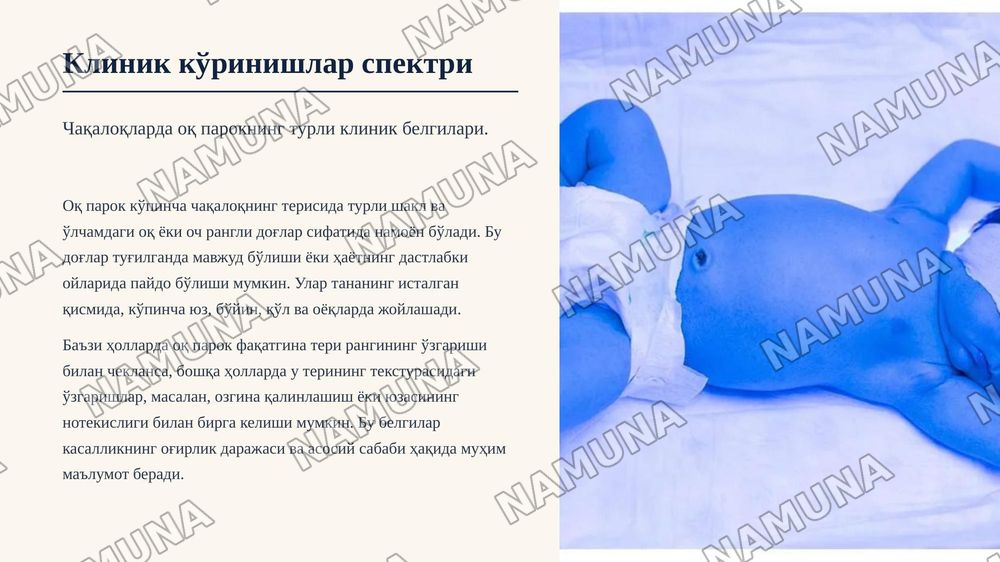 Неонатал чакалокларда ок парок касаллиги — zamonaviy taqdimot, 7-slayd