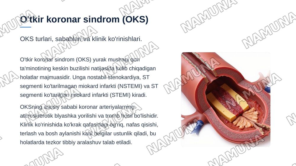 Kardiologiyada shoshilinch tibbiy yordam talab qiluvchi holatlar — zamonaviy taqdimot, 5-slayd