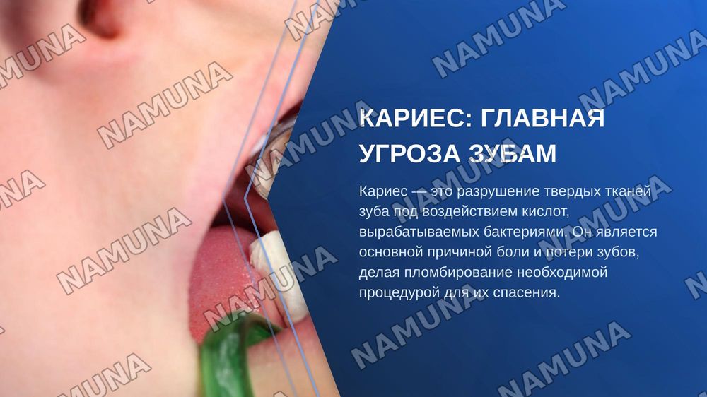 Пломбы — zamonaviy taqdimot, 3-slayd