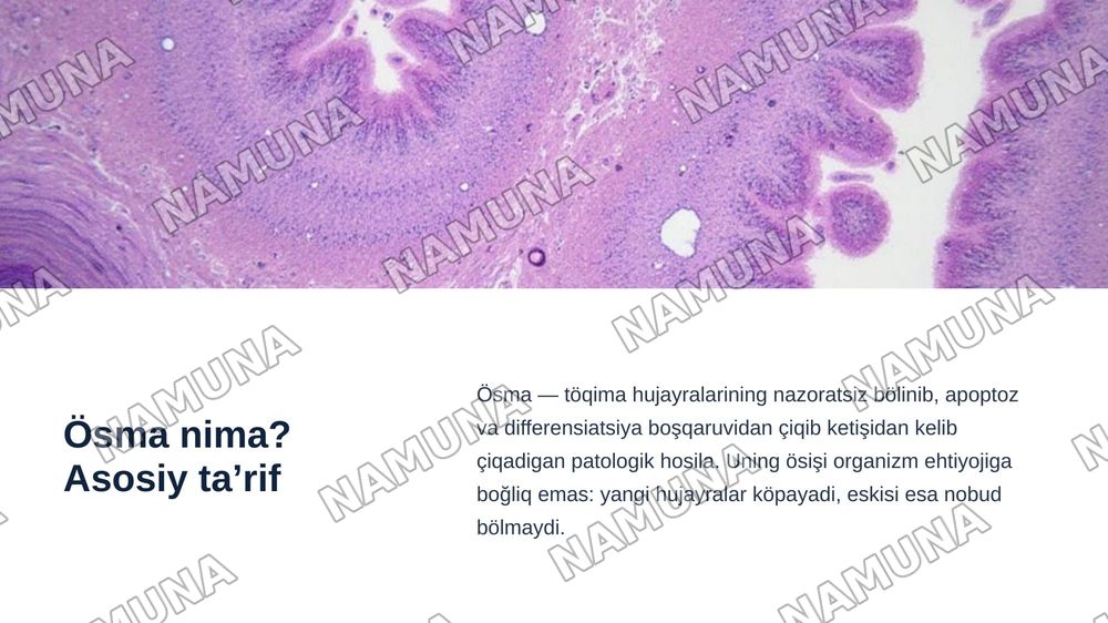 O'smalarning biologik xususiyatlari.
Onkologiyada klinik gruppalar. TNM sistemasi. Onkologiyada davolash printsiplari — zamonaviy taqdimot, 4-slayd