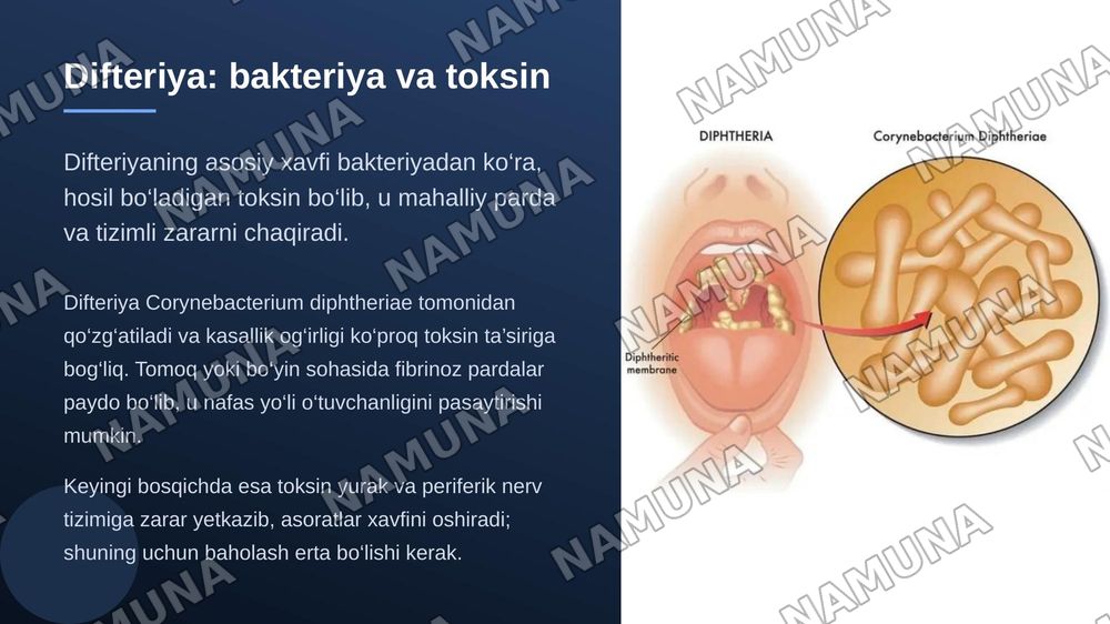 Nafas yoʻllari infeksiyalari. Difteriya. Koʻkyoʻtal. Parakoʻkyoʻtal — zamonaviy taqdimot, 4-slayd
