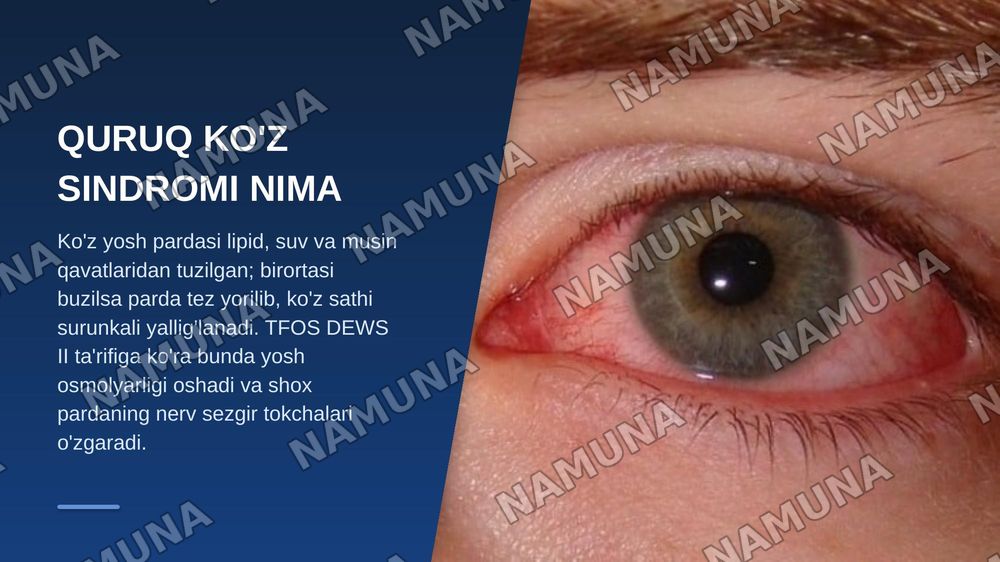 Markaziy Osiyo mintaqasida quruq ko'z sindromi muammolari — zamonaviy taqdimot, 4-slayd