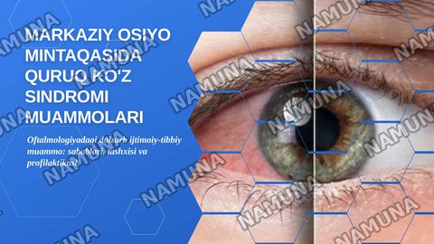 Markaziy Osiyo mintaqasida quruq ko'z sindromi muammolari — zamonaviy taqdimot