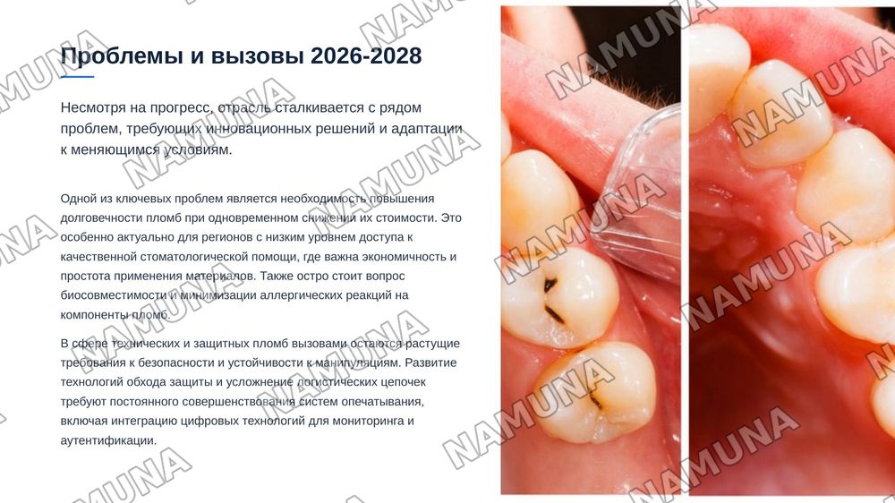 Пломбы — zamonaviy taqdimot, 8-slayd