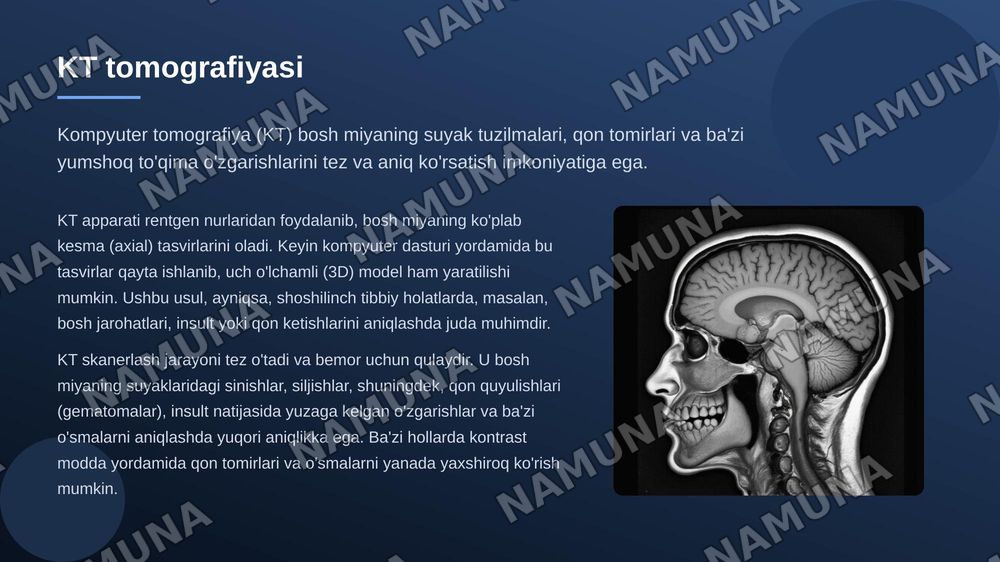 Bosh miya radiologiyasi — 6-slayd