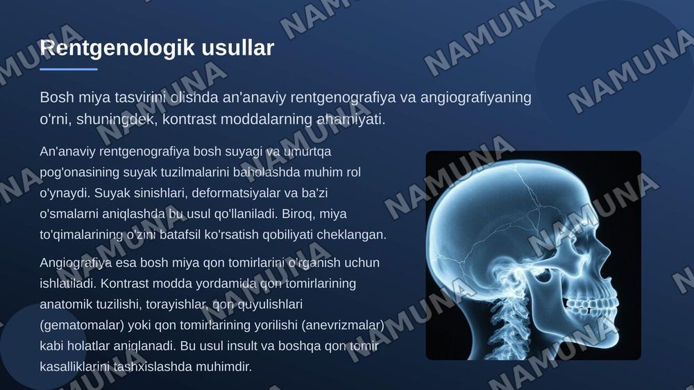 Bosh miya radiologiyasi — 7-slayd