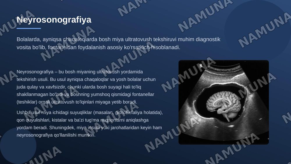 Bosh miya radiologiyasi — 8-slayd