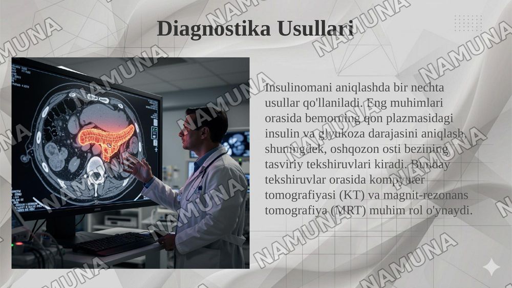 Insulinoma — 6-slayd