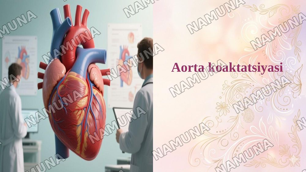 Aorta koaktatsiyasi — 1-slayd