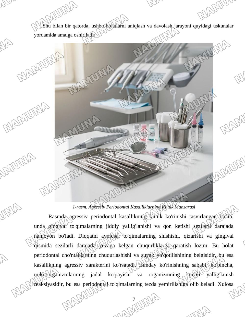Aggressive fonns of periodontal disease. Clinic, differential diagnosis, 5 treatment, prevention. I diopathic diseases - syndromes: Papillon- Lefebvre, Hend-Christian-Schiiller, Literer-Siwe.Periodont — 7-varaq