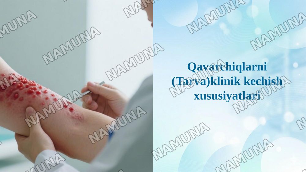 Qavarchiqlarni (Tarva)klinik kechish xususiyatlari — 1-slayd