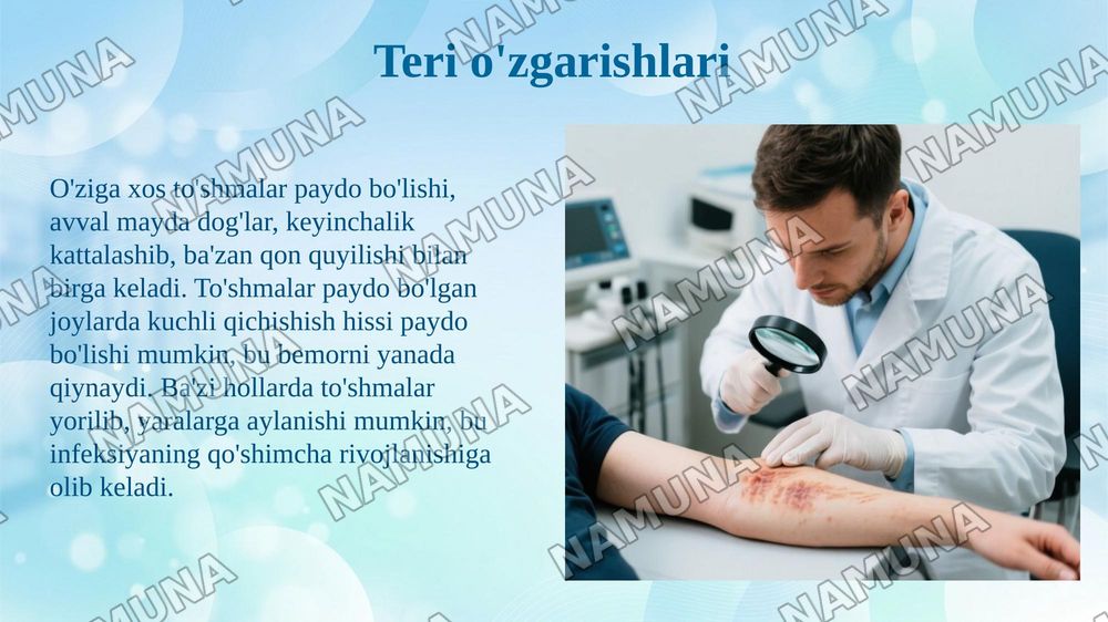 Qavarchiqlarni (Tarva)klinik kechish xususiyatlari — 7-slayd